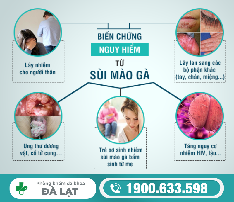 Hình ảnh minh họa